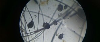 Scabies mites under a microscope
